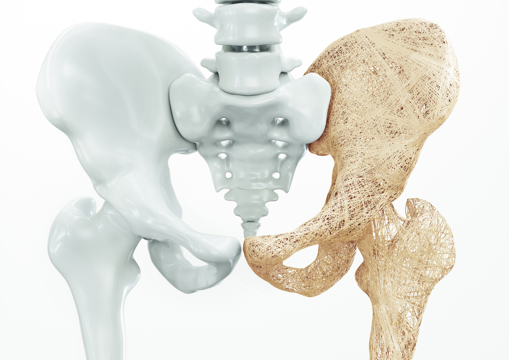 Osteogenic Growth Peptide